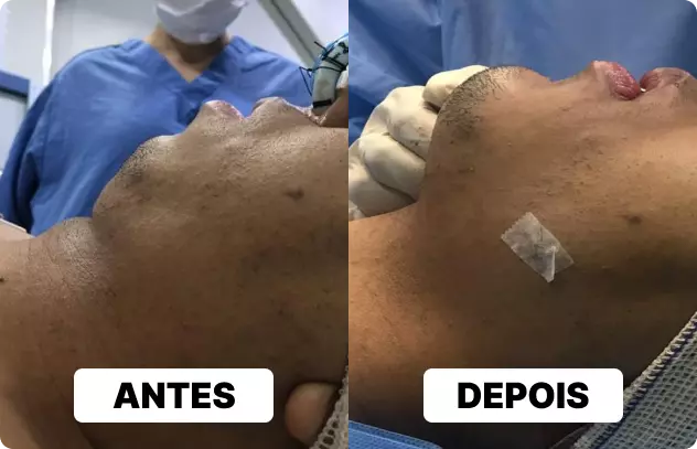 imagem de antes e depois